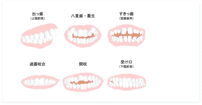 様々な歯並びに対応